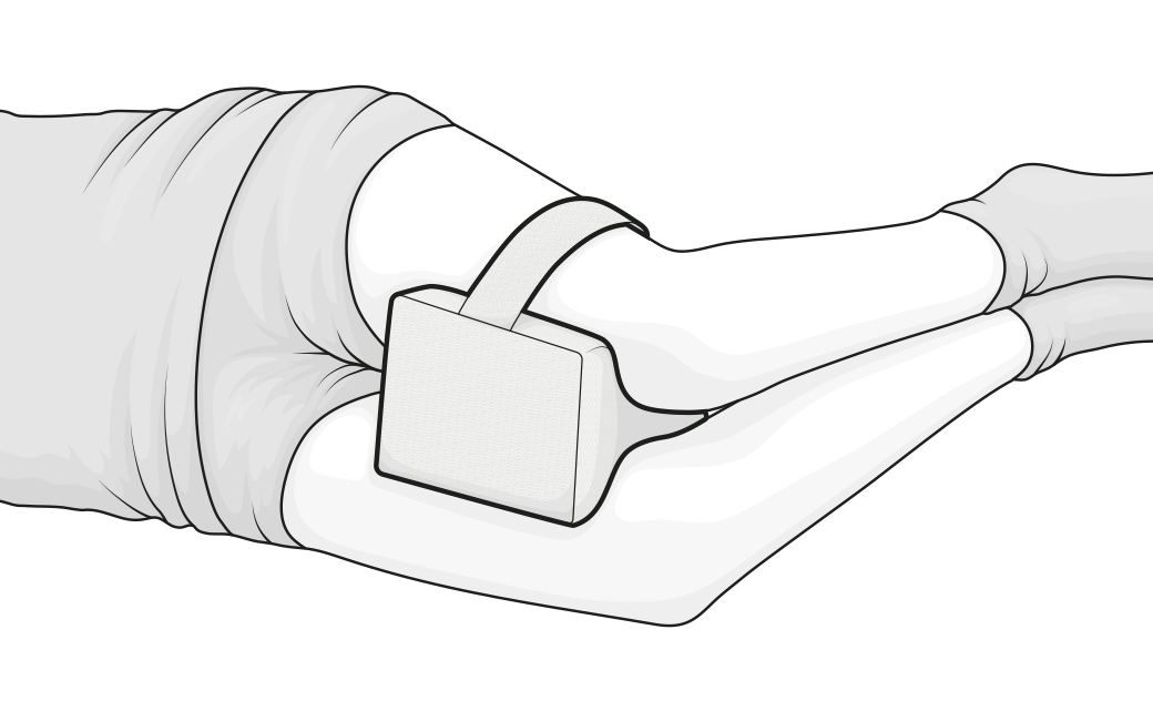 Illustration: Eine Person in Seitenlage hat das Kniekissen zwischen die Oberschenkel geklemmt.	